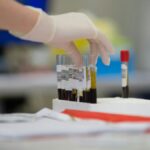 alzheimer’s blood test in india may detect disease before symptoms