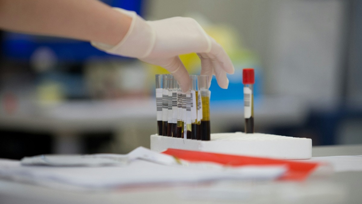 alzheimer’s blood test in india may detect disease before symptoms